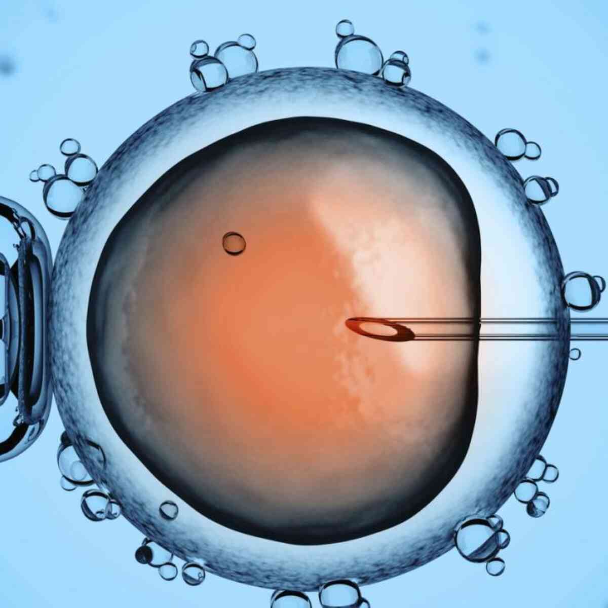 Icsi male infertility sperm