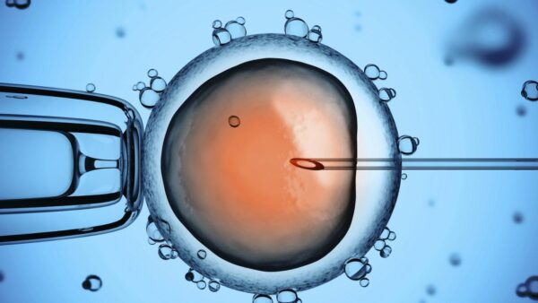 Icsi male infertility sperm 0